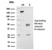 SDS-PAGE analysis of purified, BSA-free Estrogen Receptor beta antibody (clone ESR2/3207) as confirmation of integrity and purity.