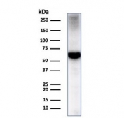 Western blot testing of human liver tissue lysate with Albumin antibody (clone ALB/2355). Predicted molecular weigth ~66 kDa.