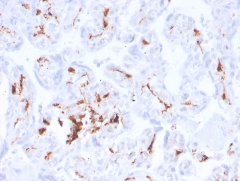 IHC staining of FFPE human placenta with re