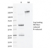 SDS-PAGE analysis of purified, BSA-free ALDH1A1 antibody (clone ALDH1A1/1381) as confirmation of integrity and purity.