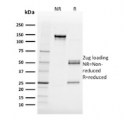 SDS-PAGE analysis of purified, BSA-free FABP5 antibody (clone FABP5/3750) as confirmation of integrity and purity.
