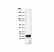 Western blot testing of human HeLa cell lysate with FABP5 antibody. Predicted molecular weight ~15 kDa.