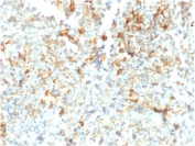 IHC staining of FFPE human testicular cancer with FCGRT antibody (clone FCGRT/2932). HIER: boil tissue sections in pH 9 10mM Tris with 1mM EDTA for 10-20 min and allow to cool before testing.