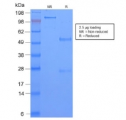 SDS-PAGE analysis of purified, BSA-free  recombinant TAG-72 antibody (clone CA72/2869R) as confirmation of integrity and purity.