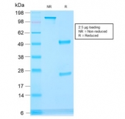 SDS-PAGE analysis of purified, BSA-free recombinant AMACR/p504S antibody (clone rAMACR/1864) as confirmation of integrity and purity.