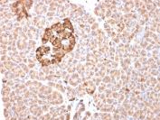 IHC staining of FFPE human pancreas with FTH1 antibody (clone FTH/2081). HIER: boil tissue sections in pH 9 10mM Tris with 1mM EDTA for 10-20 min and allow to cool before testing.