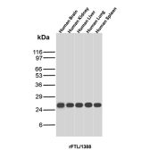 FTL Antibody Multi-Tissue WB. Western blot analysis of human brain, kidney, liver, lung, and spleen tissue lysates using FTL Antibody detects strong bands at approximately 24 kDa across all tested tissues, consistent with ferritin light chain / FTL. The broad tissue expression profile supports the established role of this intracellular iron storage protein in ferritin complex assembly, iron sequestration, oxidative stress response, and cellular iron homeostasis across metabolically active human tissues.