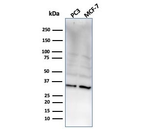 Western blot testing of human PC-3 and MCF-7 cell lysate with NKX2.8 antibody. Predicted molecular weight ~26 kDa, commonly observed at 26-34 kDa.~