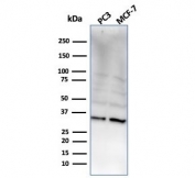 Western blot testing of human PC-3 and MCF-7 cell lysate with NKX2.8 antibody. Predicted molecular weight ~26 kDa, commonly observed at 26-34 kDa.