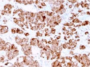 IHC testing of FFPE human pituitary with Growth Hormone antibody (clone GH/3155). Required HIER: boil tissue sections in pH 9 10mM Tris with 1mM EDTA for 10-20 min.