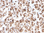 IHC testing of FFPE human pituitary with Growth Hormone antibody (clone GH/3155). Required HIER: boil tissue sections in pH 9 10mM Tris with 1mM EDTA for 10-20 min.
