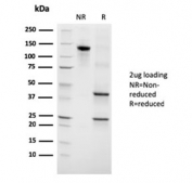 SDS-PAGE analysis of purified, BSA-free recombinant Growth Hormone antibody (clone GH/3155) as confirmation of integrity and purity.