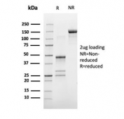 SDS-PAGE analysis of purified, BSA-free Estrogen Receptor alpha antibody (clone ESR1/3373) as confirmation of integrity and purity.
