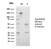SDS-PAGE analysis of purified, BSA-free CELA3B antibody (clone rCELA3B/1811) as confirmation of integrity and purity.