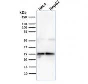 Western blot testing of human HeLa and HepG2 cell lysate with Glyoxalase 1 antibody (clone CPTC-GLO1-3). Predicted molecular weight ~21 kDa.