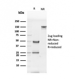 SDS-PAGE analysis of purified, BSA-free Glycoprotein 2 antibody (clone GP2/3416) as confirmation of integrity and purity.