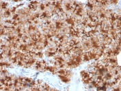 IHC testing of FFPE human pancreas with Glycoprotein 2 antibody (clone GP2/3416). HIER: boil tissue sections in pH 9 10mM Tris with 1mM EDTA for 10-20 min and allow to cool before testing.