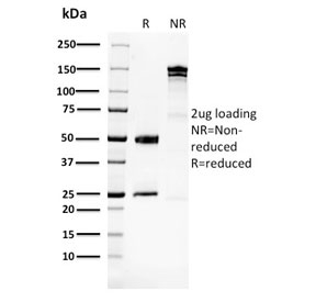 SDS-PAGE analysis of purified, BSA-free Glucose 6-Phosphate Isomerase antibody (clone CPTC-GPI-1) as confirmation of integrity and purity.