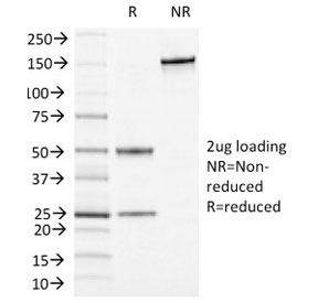 SDS-PAGE analysis of purified, BSA-free CD13 antibody (clone APN/1464) as confirmation of integrity and purity.