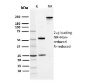 SDS-PAGE analysis of purified, BSA-free PD-L1 antibody (clone PDL1/2742) as confirmation of integrity and purity.