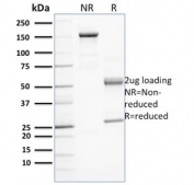 SDS-PAGE analysis of purified, BSA-free PD-L1 antibody (clone PDL1/2743) as confirmation of integrity and purity.