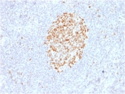 IHC staining of FFPE human lymph node with MSH6 antibody (clone MSH6/2927). HIER: boil tissue sections in pH 9 10mM Tris with 1mM EDTA for 10-20 min and allow to cool before testing.