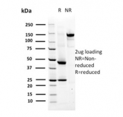 SDS-PAGE analysis of purified, BSA-free MSH6 antibody (clone MSH6/2927) as confirmation of integrity and purity.