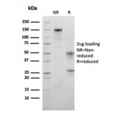 SDS-PAGE analysis of purified, BSA-free MSH6 antibody (clone MSH6/3089) as confirmation of integrity and purity.