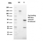 SDS-PAGE analysis of purified, BSA-free recombinant Glycophorin A antibody (clone GYPA/3219R) as confirmation of integrity and purity.