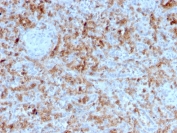 IHC staining of FFPE human spleen with Granzyme B antibody (clone GZMB/3055). HIER: boil tissue sections in pH 9 10mM Tris with 1mM EDTA for 10-20 min and allow to cool before testing.