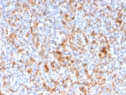 IHC staining of FFPE human spleen with Granzyme B antibody (clone GZMB/3056). HIER: boil tissue sections in pH 9 10mM Tris with 1mM EDTA for 10-20 min and allow to cool before testing.