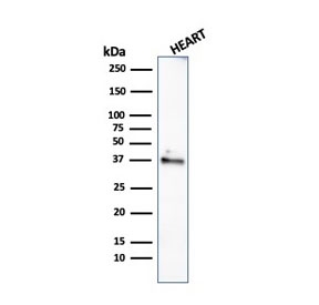Western blot testing of human heart lysate with recombinant Histone H1 antibody (clone rAE-4). Predicted molecular weight ~20 kDa but can be observed at 27-30 kDa.