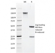 SDS-PAGE analysis of purified, BSA-free recombinant Histone H1 antibody (clone rAE-4) as confirmation of integrity and purity.