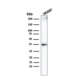 Western blot testing of human heart lysate with recombinant Histone H1 antibody (clone AE-4). Predicted molecular weight ~20 kDa but can be observed at 27-30 kDa.