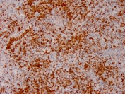 IHC staining of FFPE human lymph node with Annexin A1 antibody (clone ANXA1/3566). HIER: boil tissue sections in pH 9 10mM Tris with 1mM EDTA for 10-20 min and allow to cool before testing.