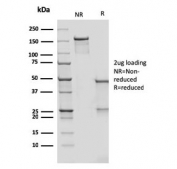 SDS-PAGE analysis of purified, BSA-free recombinant CD209 antibody (clone rC209/1781) as confirmation of integrity and purity.