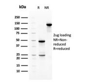 SDS-PAGE analysis of purified, BSA-free Neuregulin-1 antibody (clone NRG1/2710) as confirmation of integrity and purity.