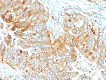 IHC staining of FFPE human endometrium with HLA-DRB1 antibody (clone DA2). HIER: boil tissue sections in pH 9 10mM Tris with 1mM EDTA for 10-20 min and allow to cool before testing.~