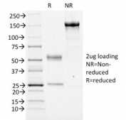 SDS-PAGE analysis of purified, BSA-free FOXA1 antibody (clone FOXA1/1516) as confirmation of integrity and purity.