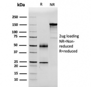 SDS-PAGE analysis of purified, BSA-free Serum Amyloid P antibody (clone APCS/3240) as confirmation of integrity and purity.