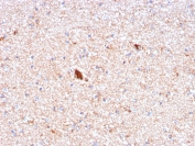 IHC staining of FFPE human brain with Serum Amyloid P antibody (clone APCS/3240). HIER: boil tissue sections in pH 9 10mM Tris with 1mM EDTA for 10-20 min and allow to cool before testing.