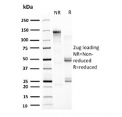 SDS-PAGE analysis of purified, BSA-free HSP60 antibody (clone CPTC-HSPD1-1) as confirmation of integrity and purity.