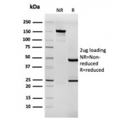 SDS-PAGE analysis of purified, BSA-free Tenascin C antibody (clone rTNC/3635) as confirmation of integrity and purity.