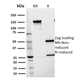 SDS-PAGE analysis of purified, BSA-free ICAM1 antibody (clone 15.2) as confirmation of integrity and purity.