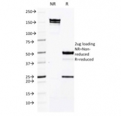 SDS-PAGE analysis of purified, BSA-free CD50 antibody (clone CG106) as confirmation of integrity and purity.