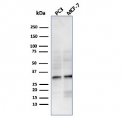 Western blot testing of human PC-3 and MCF-7 cell lysate with NKX2.8 antibody. Predicted molecular weight ~26 kDa, commonly observed at 26-34 kDa.