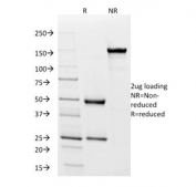 SDS-PAGE analysis of purified, BSA-free IgD antibody (clone IgD26) as confirmation of integrity and purity.
