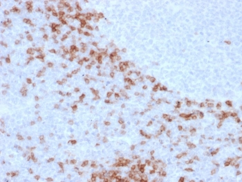 IHC staining of FFPE human lymph node with human IgD antibody (clone IgD26). HIER: boil tissue sections in pH 9 10mM Tris with 1mM EDTA for 10-20 min and allow to cool before testing.~