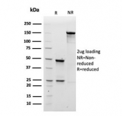 SDS-PAGE analysis of purified, BSA-free recombinant IgM antibody (clone rIM260) as confirmation of integrity and purity.