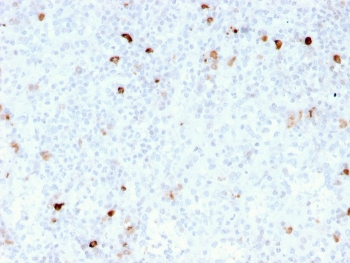 IHC staining of FFPE human tonsil with recombinant IgM antibody (clone rIM260). HIER: boil tissue sections in pH 9 10mM Tris with 1mM EDTA for 10-20 min and allow to cool before testing.~